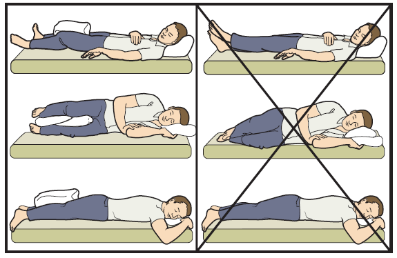 Figura 9. Posiciones para dormir después de un reemplazo de cadera