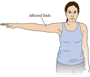 Figure 2. Arm raised 90 degrees