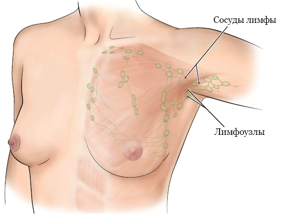 Рисунок 1.  Лимфатическая система в груди и в области подмышки