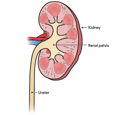 图 1. 肾脏、肾盂和输尿管