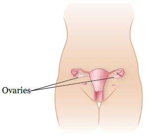 Figure 1. Location of ovaries before ovarian transposition surgery