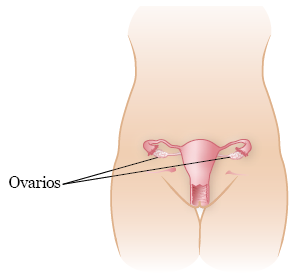 Figura 1. Ubicación de los ovarios antes de la cirugía de trasposición ovárica