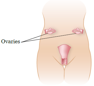 Рисунок 2.  Расположение яичников после операции по транспозиции