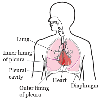 Figure 1. Your lungs and pleural cavity