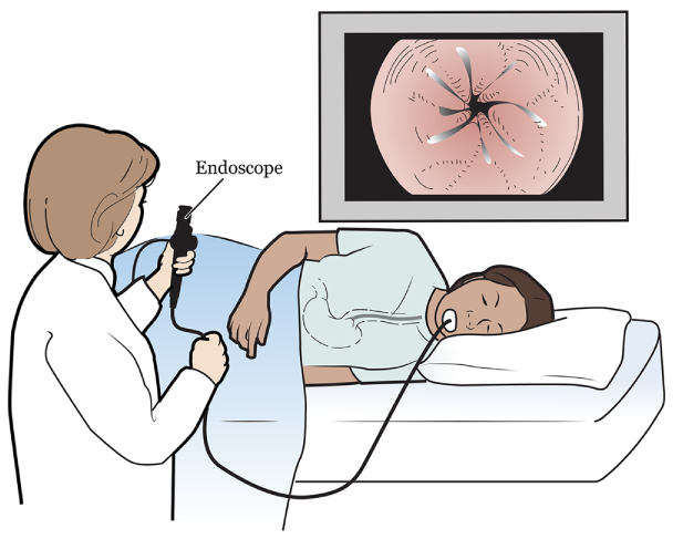 Figura 2. Médica guiando el endoscopio