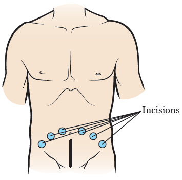 istoric medical prostatita