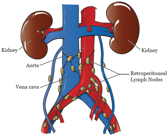 Para Aortic Lymph Nodes Normal Size