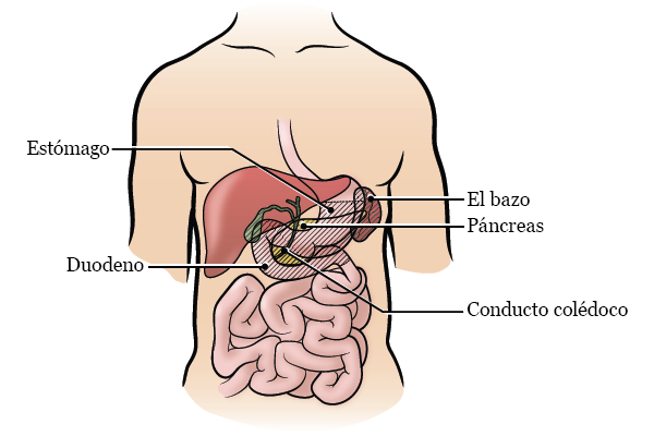 Figura 2. Órganos que se extirparán durante la cirugía
