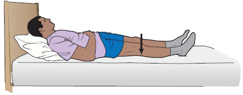 Figure 2. Quadricep (Quad) Sets