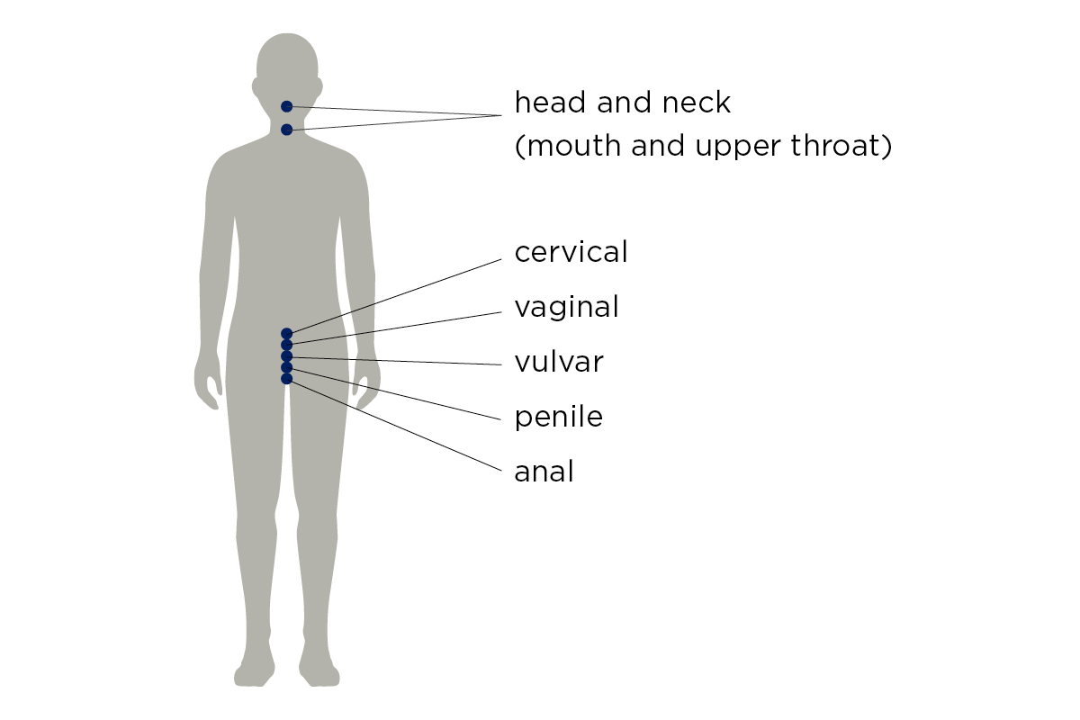 圖 1. 由 HPV 引起的 6 種癌症