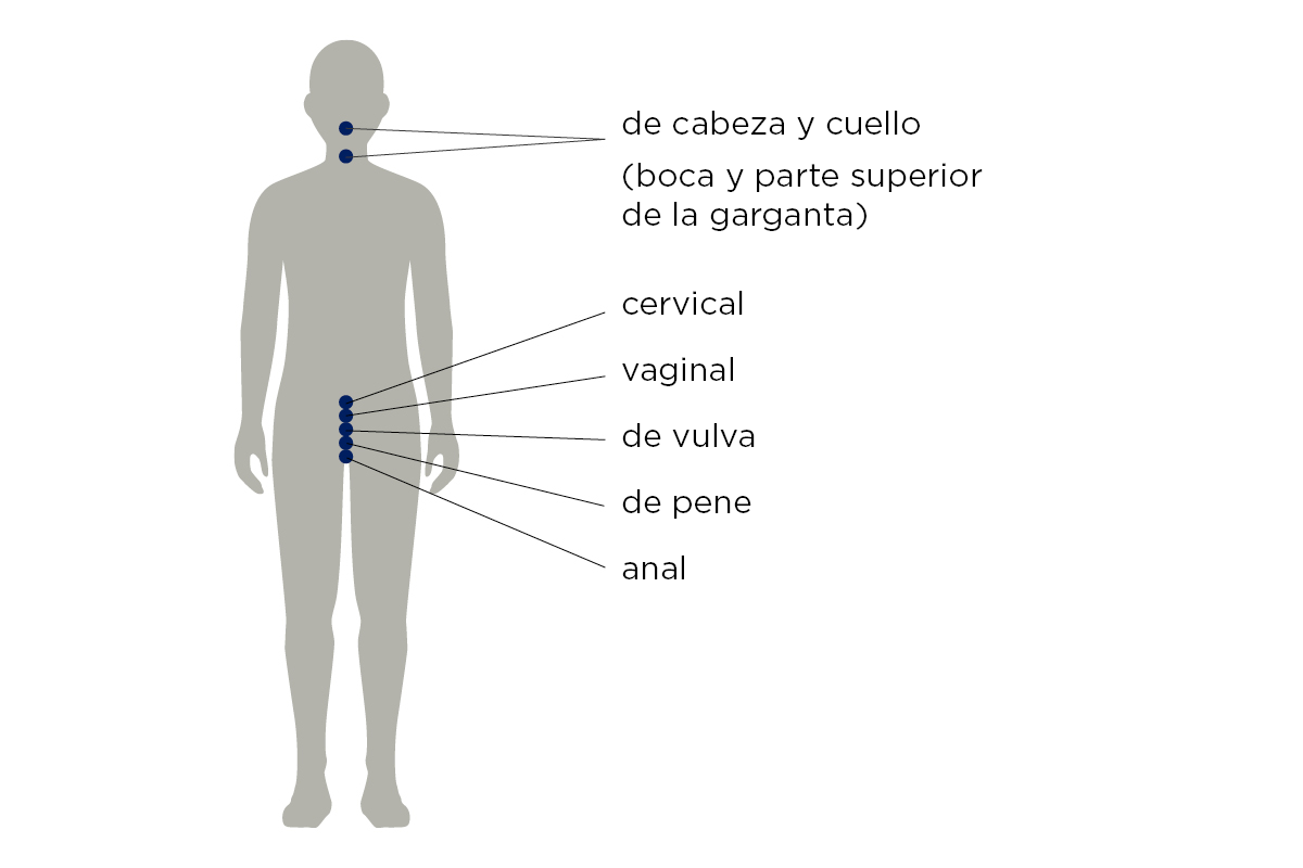 Figura 1. 6 tipos de cáncer causados por el VPH