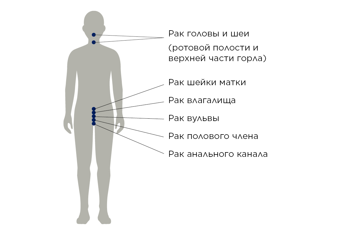 Рисунок 1. 6 видов рака, вызываемых вирусом папилломы человека