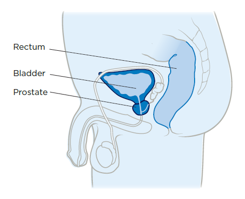 Figura 1. Anatomía de la próstata 