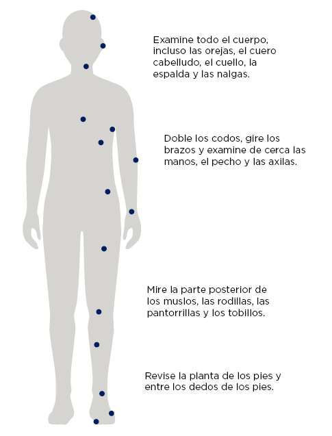 Figura 1. Sugerencias para revisarse la piel.