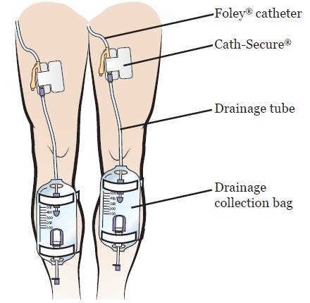 Urinary Leg Bag - Sterile | Hollister AU