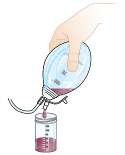 Figure 2. Emptying the bulb