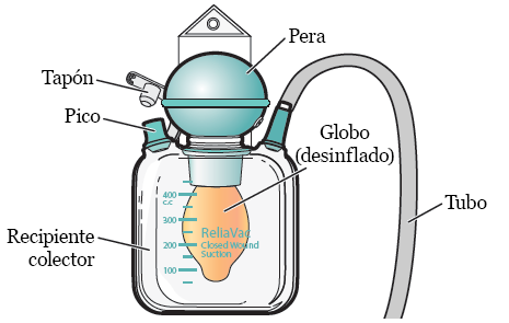 Figura 2. Drenaje ReliaVac con globo inflado