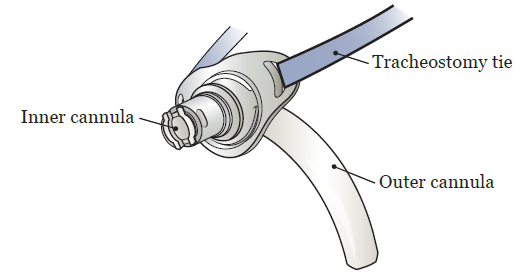 Figura 2. Cánula interna y cánula externa