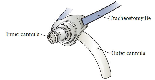 Figure 2. Inner and outer cannulas