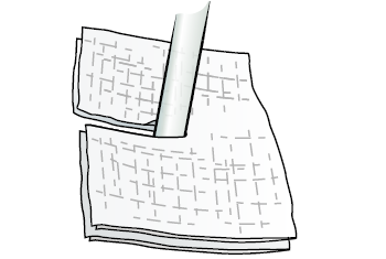 Рисунок 3.  Размещение марлевых салфеток вокруг плевральной дренажной трубки