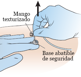 Figura 7. Saque la aguja del puerto implantado