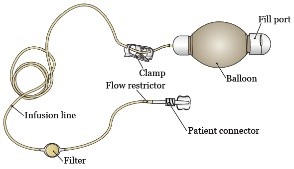 Figure 1. Parts of your elastomeric pump