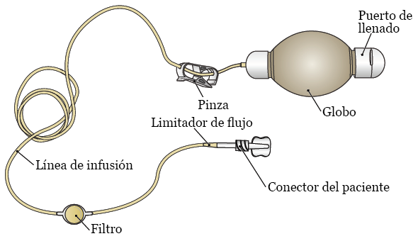 Figura 1. Partes de la bomba elastomérica