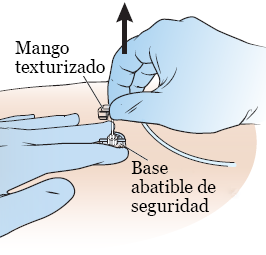 Figura 1. Tirar hacia arriba del mango poroso