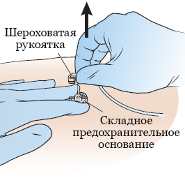 Рисунок 1.  Поднятие шероховатой рукоятки