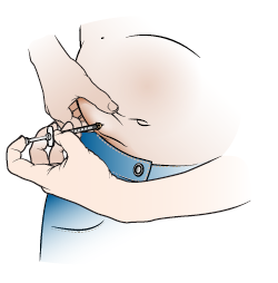 Figure 2. Giving the injection