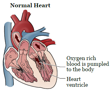 Рисунок 1.  Здоровое сердце
