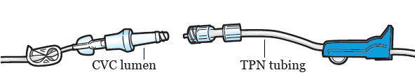 Figure 18. Attaching the TPN tubing to the CVC lumen