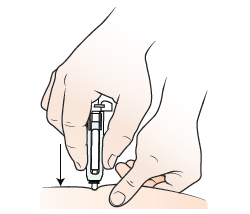 Figura 3. Introduzca la aguja en la piel