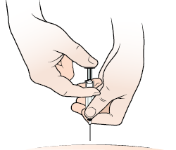 Figure 5. Hold the needle guard
