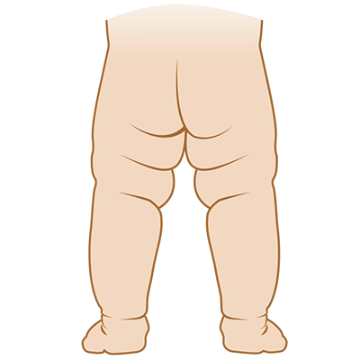 Back of child's lower body