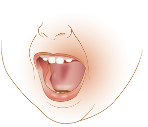 Right side of the inside of a child's mouth