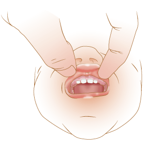 Inside of a child's upper lip