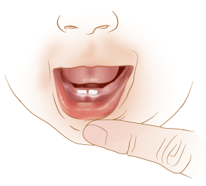 Inside of a child's lower lip
