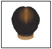 Figura 5. Fotografía de la parte superior del cuero cabelludo