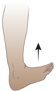 Foot flexed upward towards shin