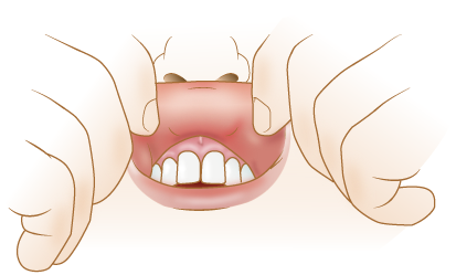 Interior del labio superior