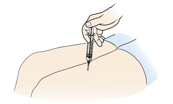 Figure 6. Injecting the glucagon