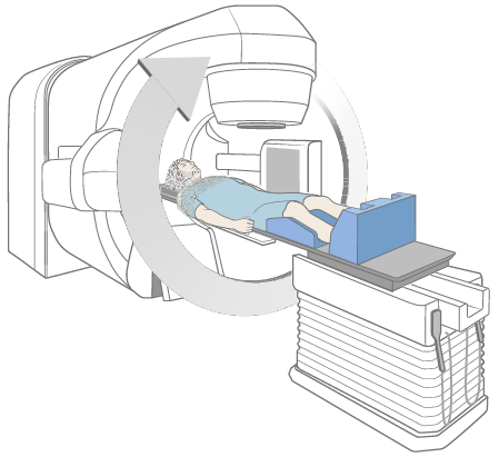 Figure 5. During treatment with upper spine mold