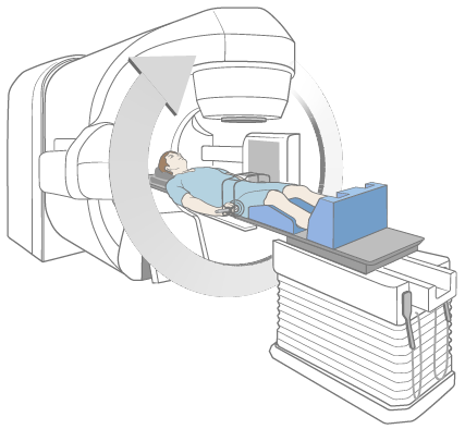 Figure 6. During treatment with lower spine mold