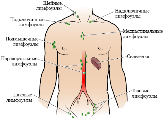 Рисунок 1.  Группы лимфоузлов в организме