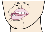Figure 6. Move your jaw to the right