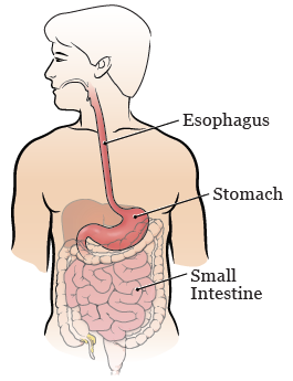 Figura 1. El esófago y el estómago antes de su cirugía.