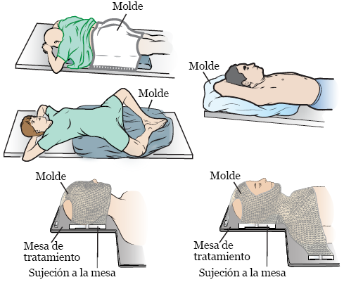 Figura 1. Ejemplos de moldes de radioterapia