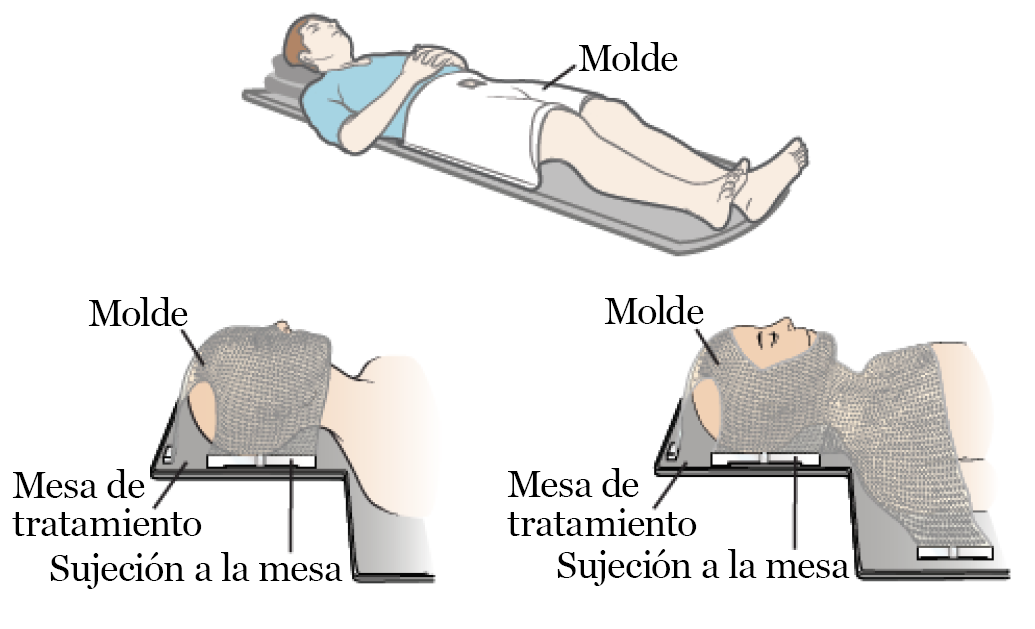 Figura 1. Ejemplos de moldes de radioterapia