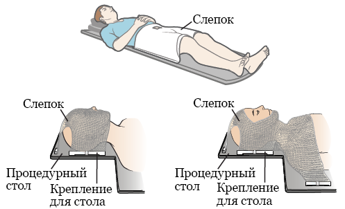 Рисунок 1.  Примеры слепков для радиотерапии